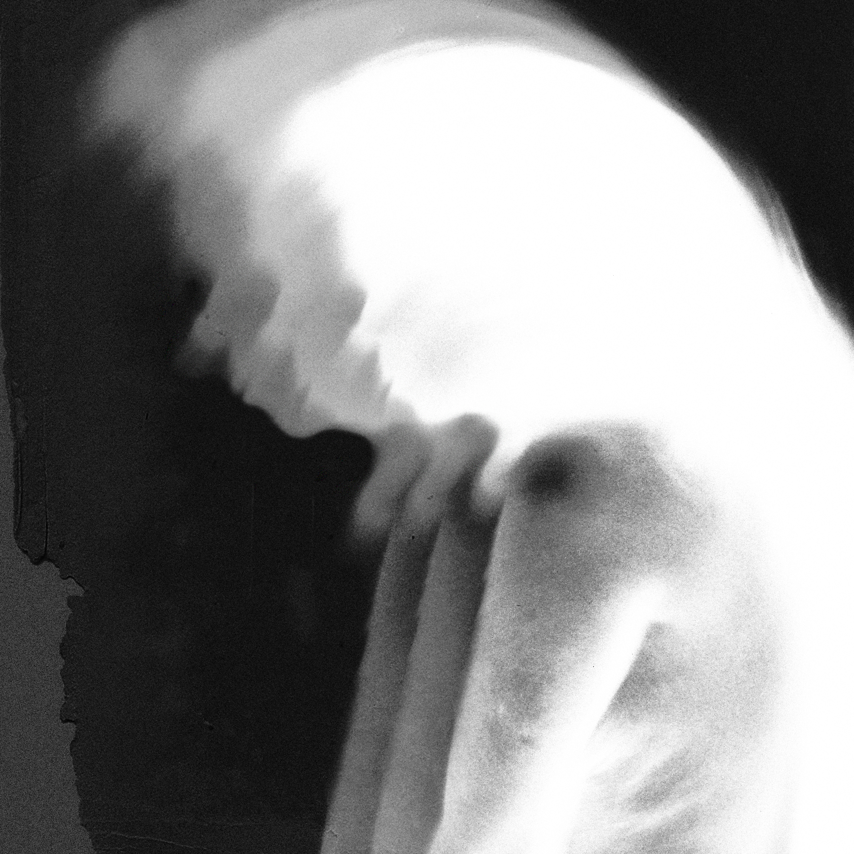 μελαγχολία