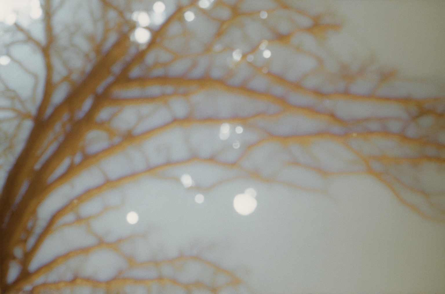 Treefingers II #9