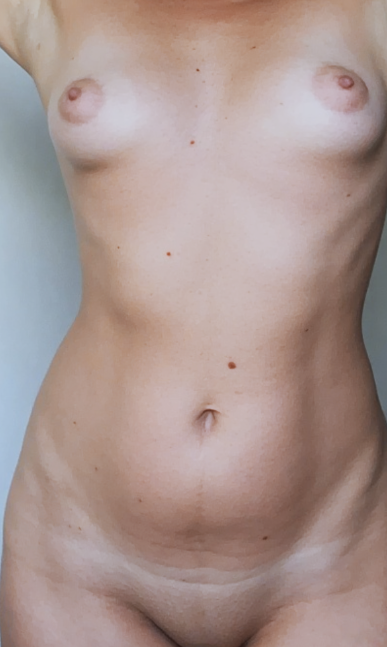 Open