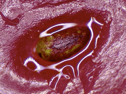 The Interfered Microscopy Plot #41