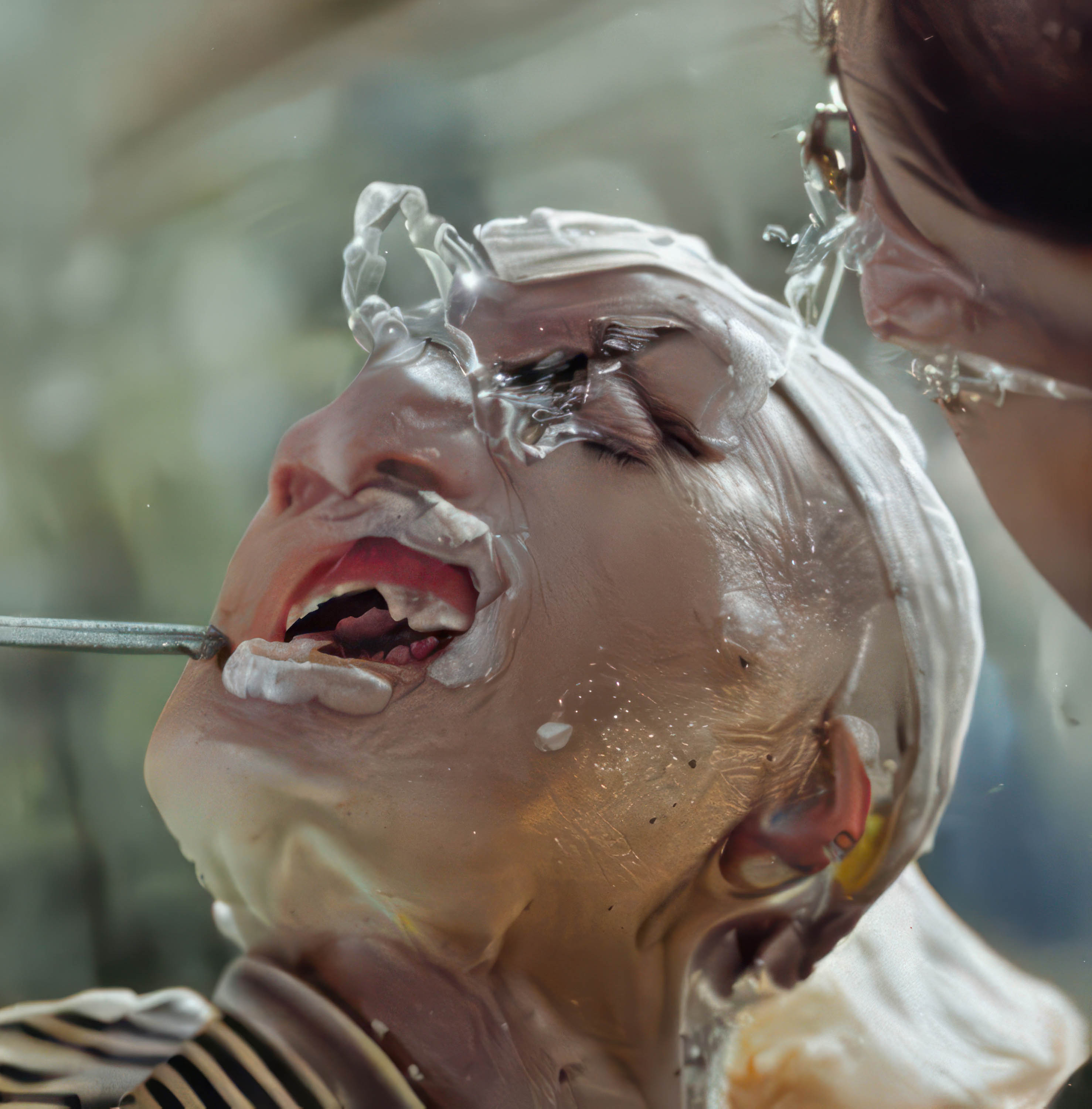 Pete Burkeet - Patient 4