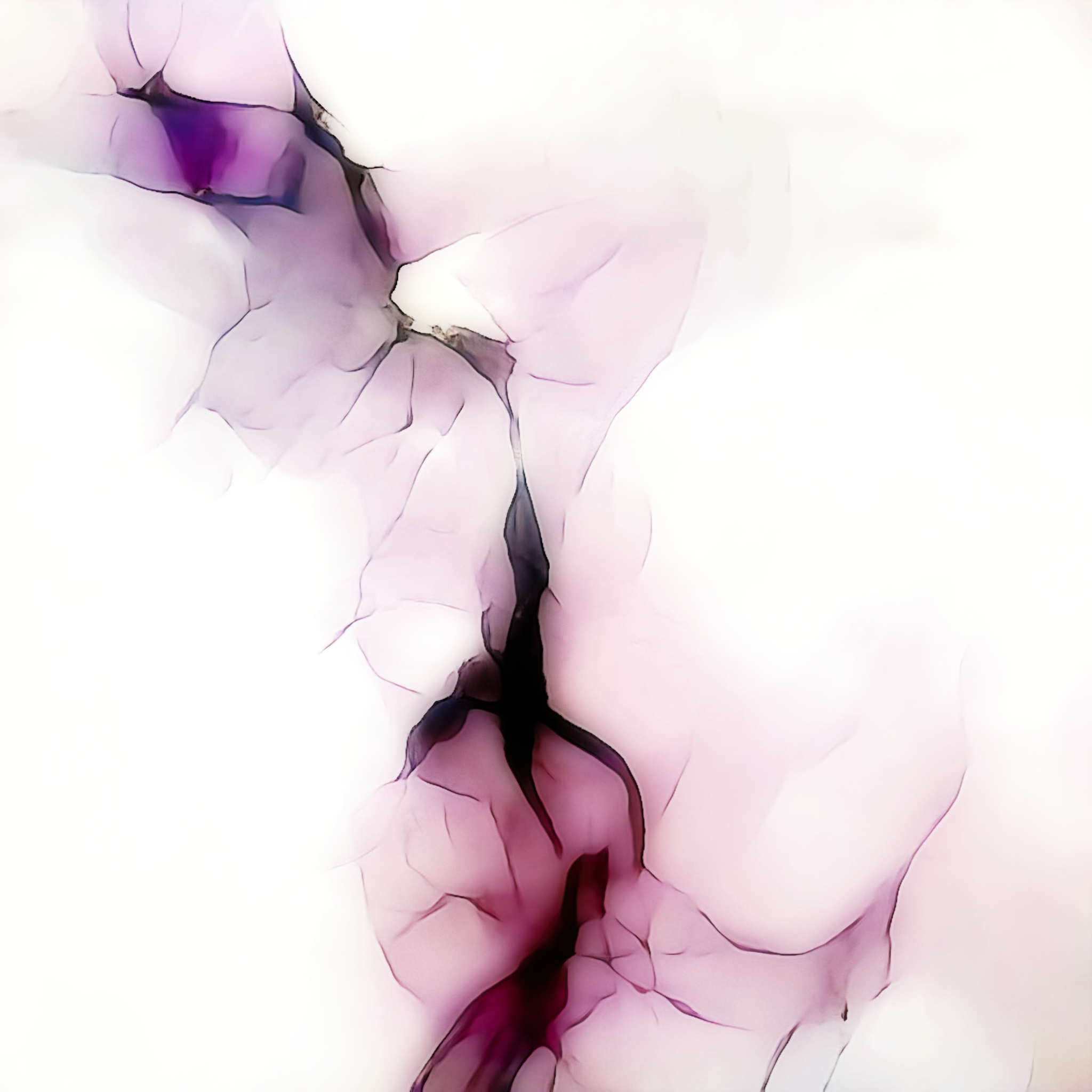 Fissure 060