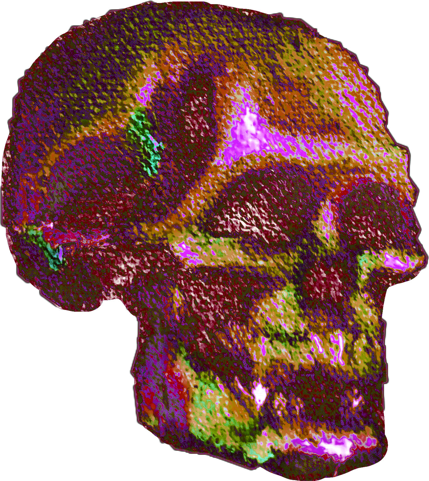 Hot Skull OPG